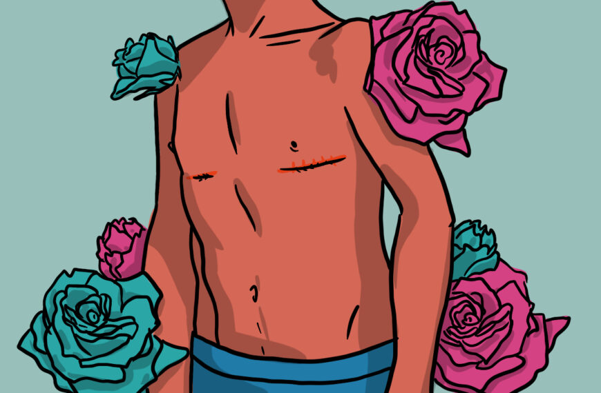 Cirurgias de redesignação sexual: Diferenças entre os procedimentos para mulheres e homens trans