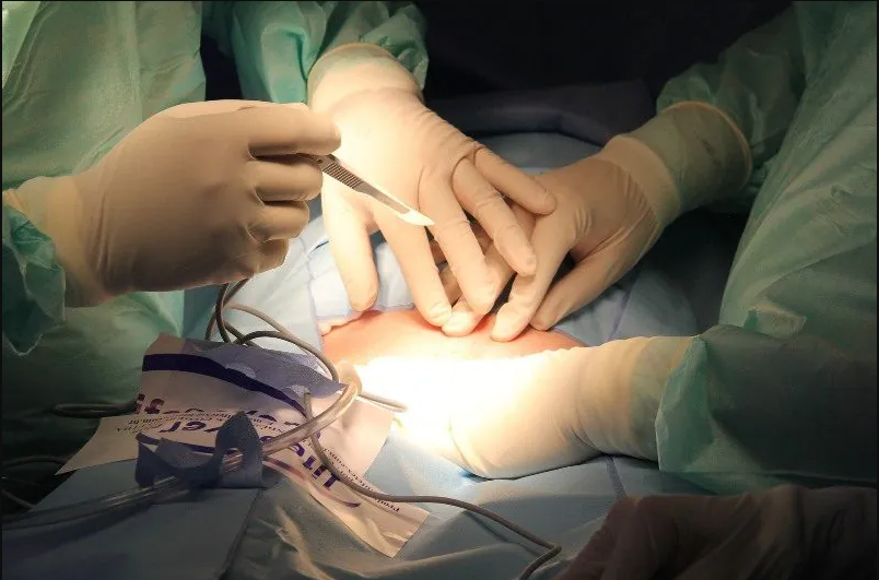 Redesignação: como é feita a cirurgia e onde fazer
