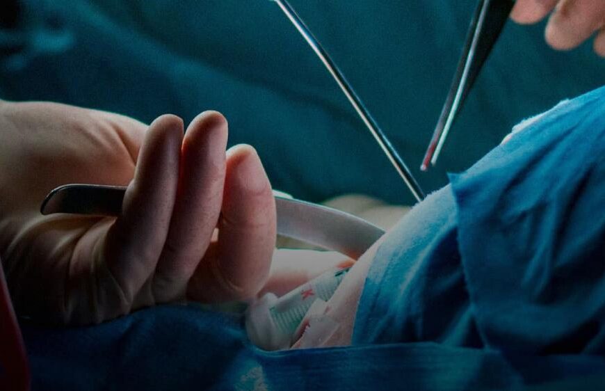Quantas horas leva uma cirurgia de redesignação de&hellip;